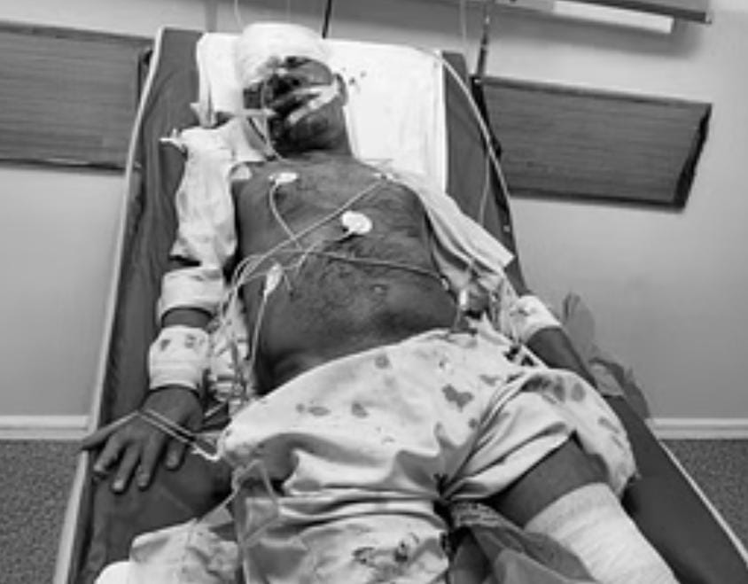 नोएडा-ग्रेटर नोएडा एक्सप्रेस वे पर फुटपाथ किनारे कार ने बुजुर्ग दंपति को मारी टक्कर, महिला की हो गई मौत