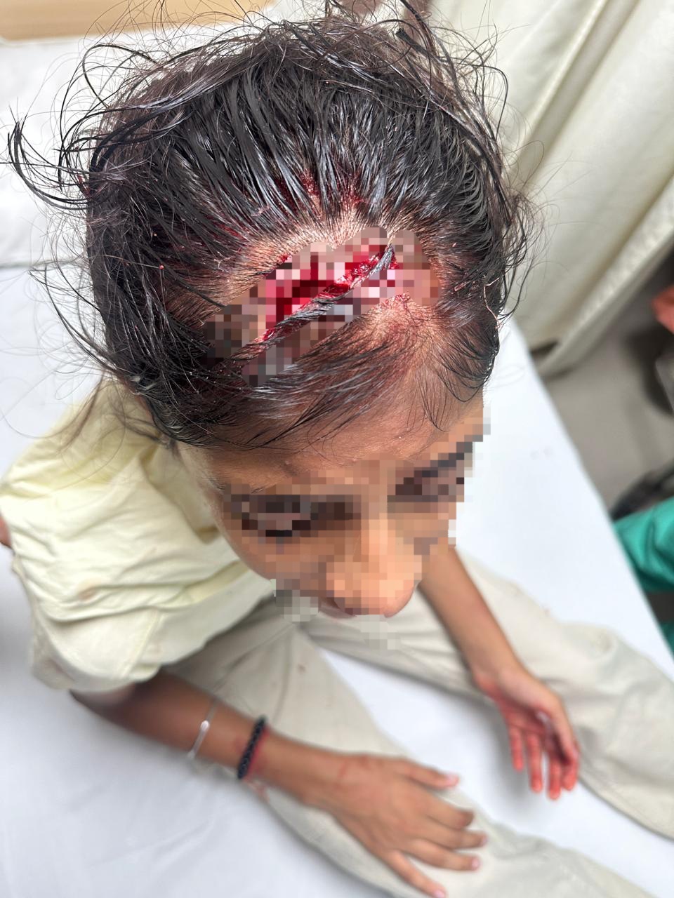 ट्यूशन पढ़कर लौट रही थी बच्‍ची और सोसायटी में हुआ हादसा: 25 वें फ्लोर से सिर पर गिरा ईट का टुकड़ा