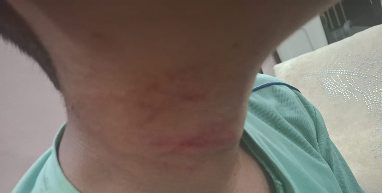 बच्‍चे ने खेलने से किया मना तो युवक बना हैवान:बच्‍चे के ऊपर बैडमिंटन से किया हमला