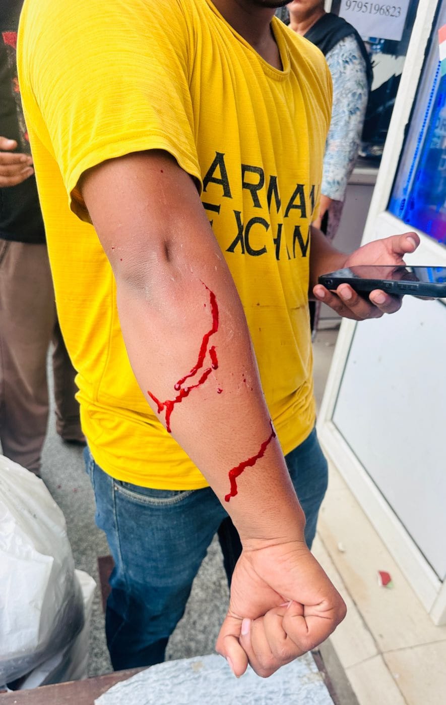 गौर सिटी सेवन एवेन्‍यू की मार्केट में मच गई अफरा-तफरी: चीख-पुकार के साथ इधर-उधर भागे मार्केट में खड़े लोग