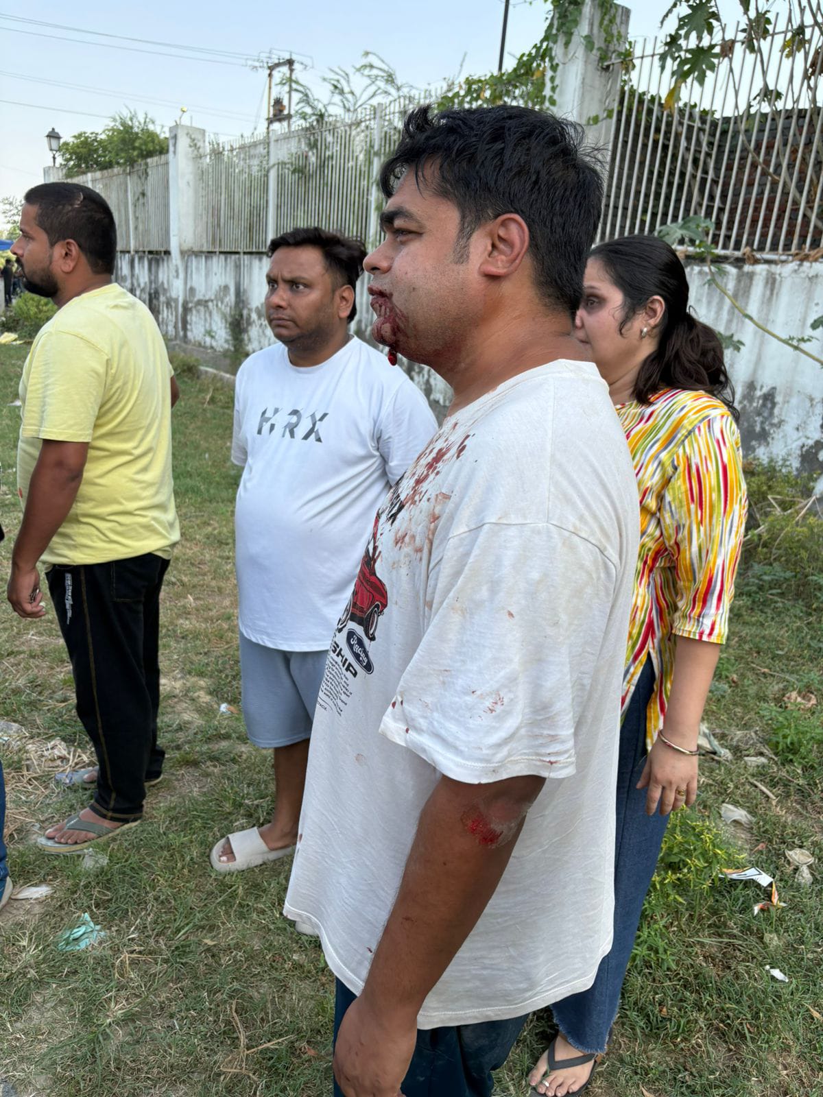 नियम का पालन करने के लिए कहना युवक को पड़ गया भारी: दबंग की पिटाई से सोसायटी निवासी हुआ लहूलुहान