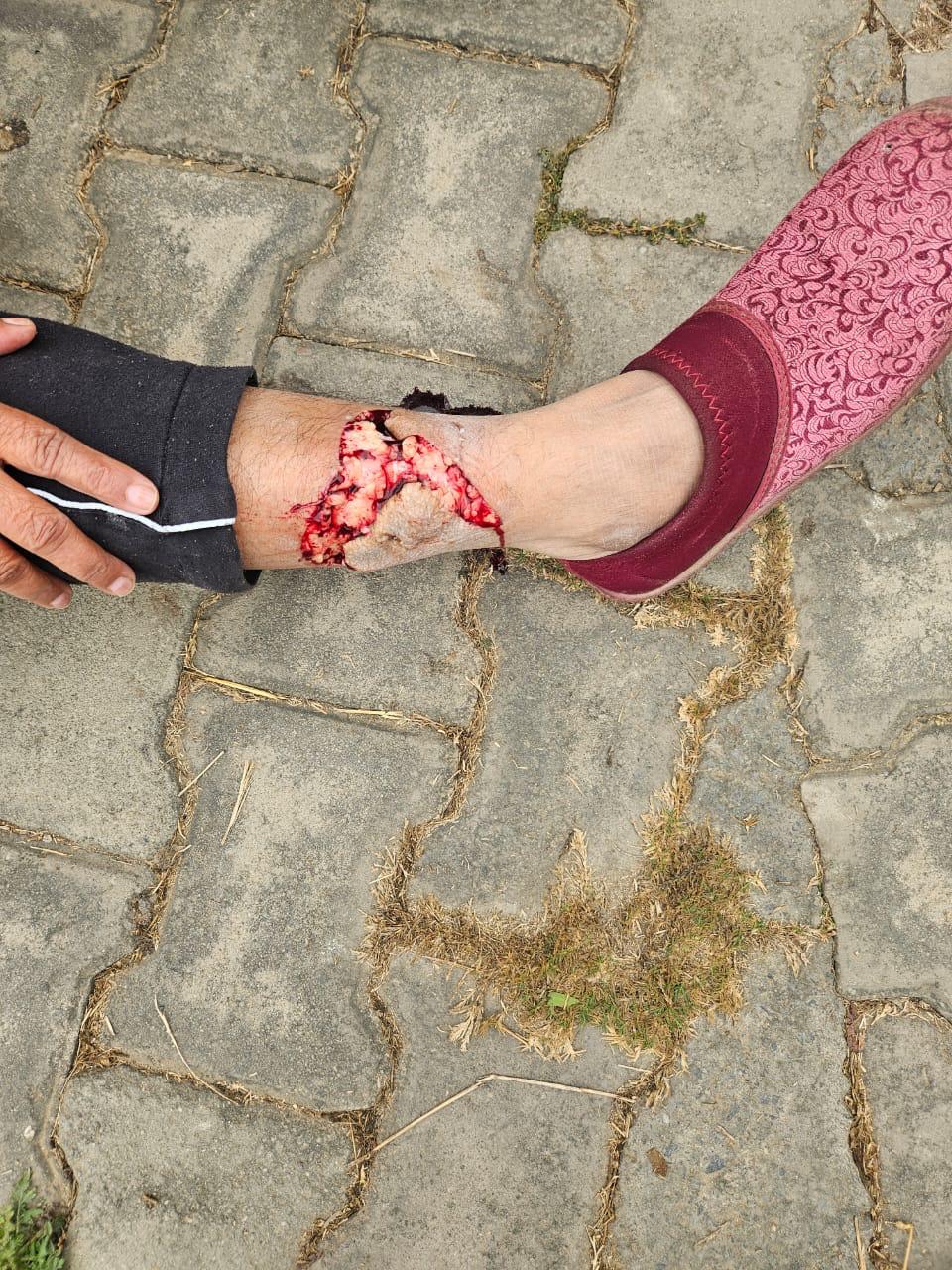 पार्क में टहल रही महिला पर अचानक हो गया हमला:कुत्‍तों के झुंड द्वारा किए गए हमले में घायल हुई महिला